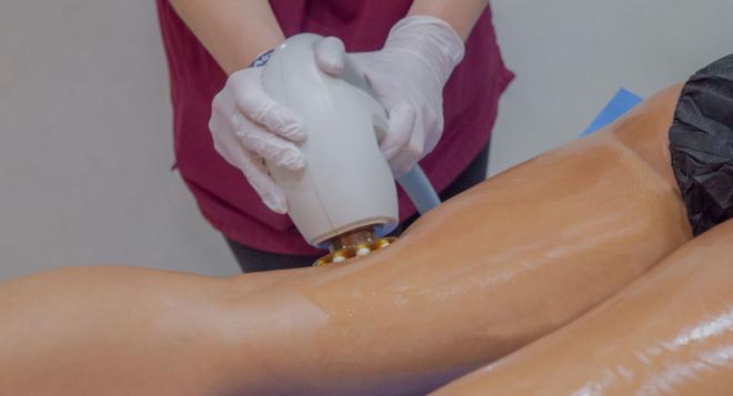 Cellulite Treatment with Accent Prime in Dubai | The Champs-Elysées Clinic